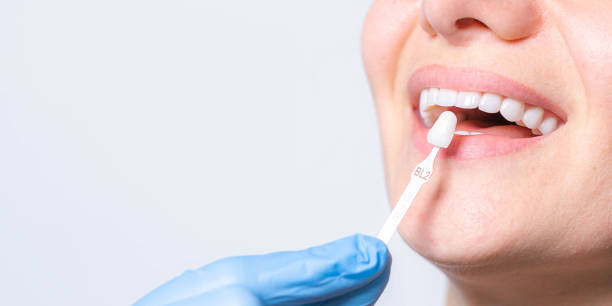 cosmetic dentist in park ridge