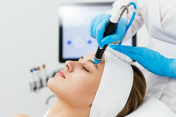 Is HydraFacial Effective for Acne and Blackheads