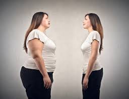Liposuction in Riyadh
