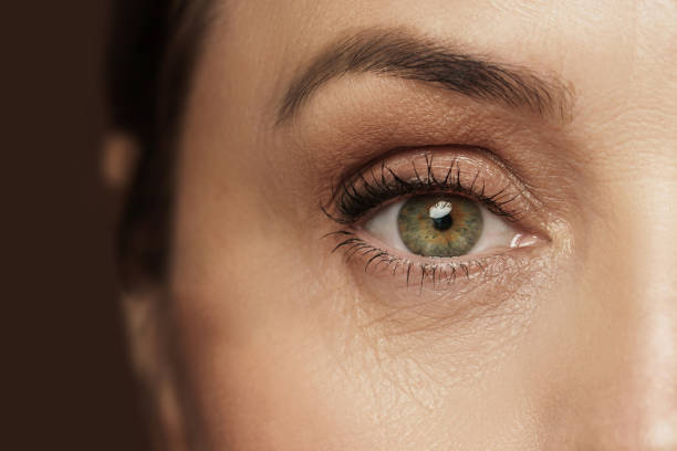 Is Eye Bag Removal Right for Aging Under-Eyes