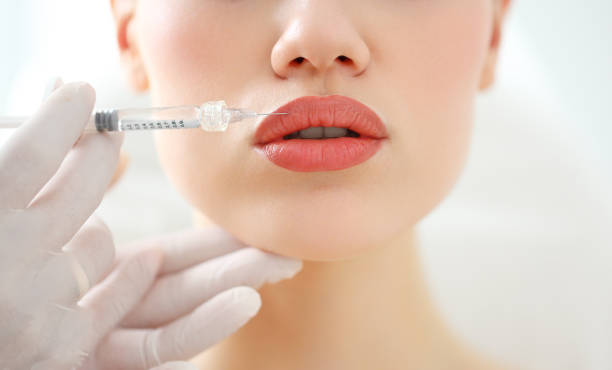 Is Lip Filler the Right Choice for Lip Contouring