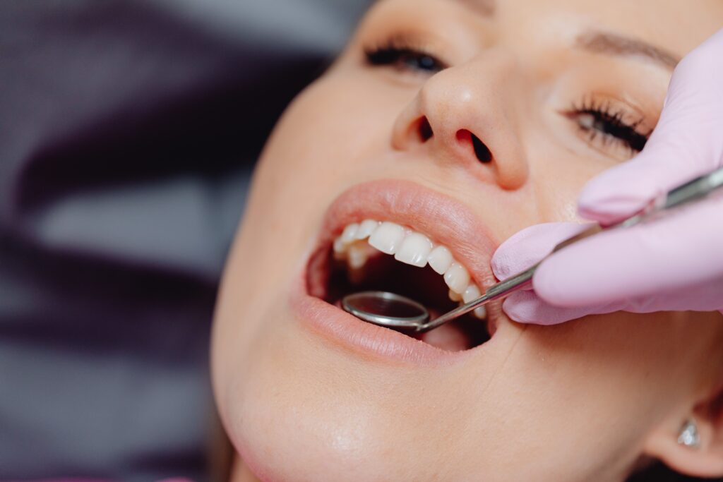 Dental Care in Rancho Cucamonga